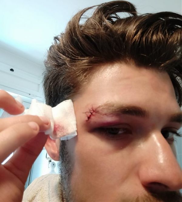 INDOSSANO MAGLIETTA ANTIFASCISTA, 4 RAGAZZI PICCHIATI A TRASTEVERE