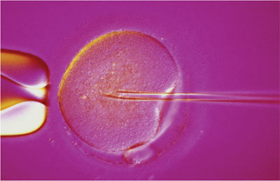 FECONDAZIONE ETEROLOGA, ANCHE NEL LAZIO