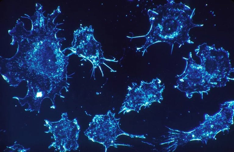 TUMORI, NUOVE SPERANZE DALLE TERAPIE AGNOSTICHE