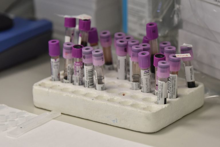 CORONAVIRUS CINESE: RIENTRA ALLARME IN ITALIA, PRIMI CASI IN EUROPA
