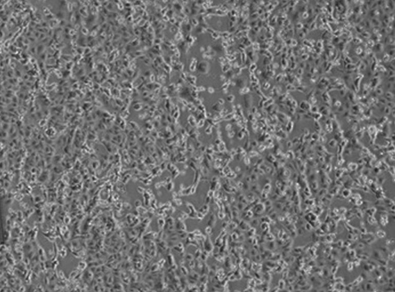 Coronavirus, i coniugi cinesi continuano a migliorare