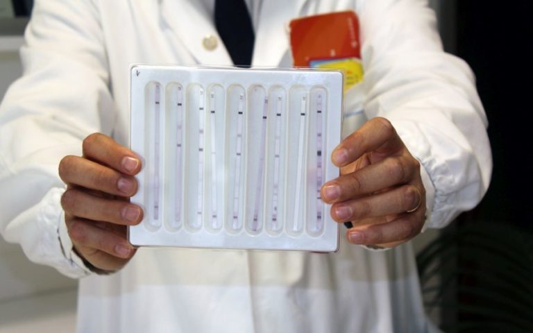 Hiv, un test ‘istantaneo’ controlla la carica virale residua nei bambini