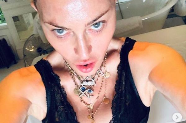 Madonna “Mi sottoporrò a un intervento di medicina rigenerativa”