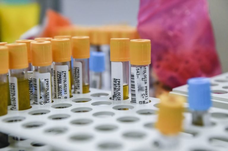 Covid, 463 nuovi casi e 2 decessi nelle ultime 24 ore