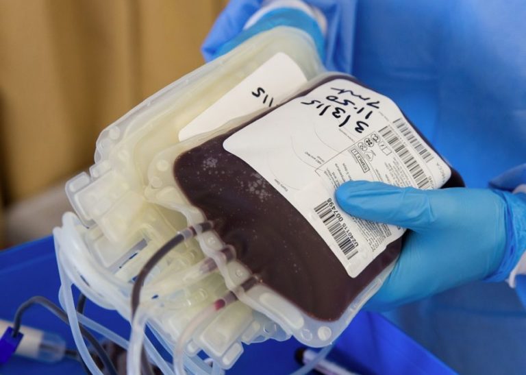 Coronavirus, Riccardi “Fvg è attrezzato per terapia al plasma”