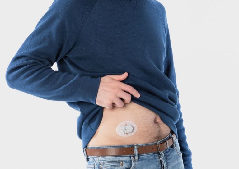 Monitoraggio glicemia, arriva il cerotto digitale di Menarini