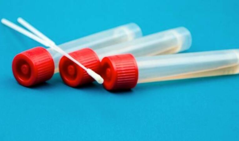 Coronavirus, in Calabria un nuovo contagio