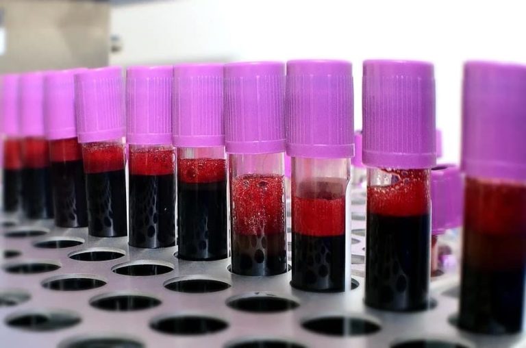 Emergenza sangue in Toscana, ad agosto donazioni in calo del 15%