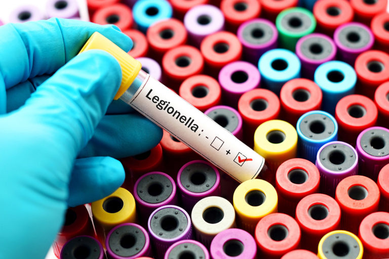 Accertati 16 casi di legionella a Busto Arsizio, un morto
