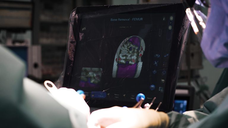 L’intelligenza artificiale per la protesi del ginocchio