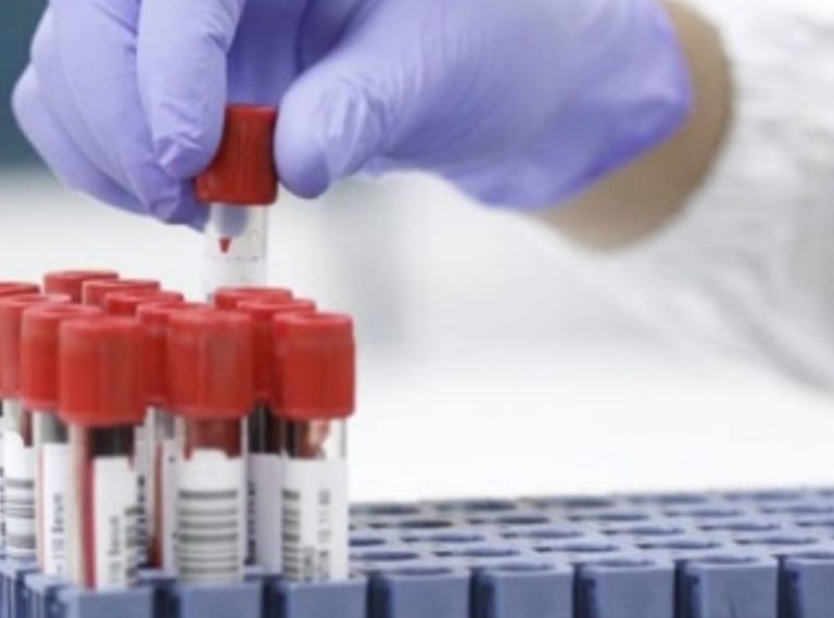 Commissione Ue dice sì ad atezolizumab per carcinoma epatocellulare