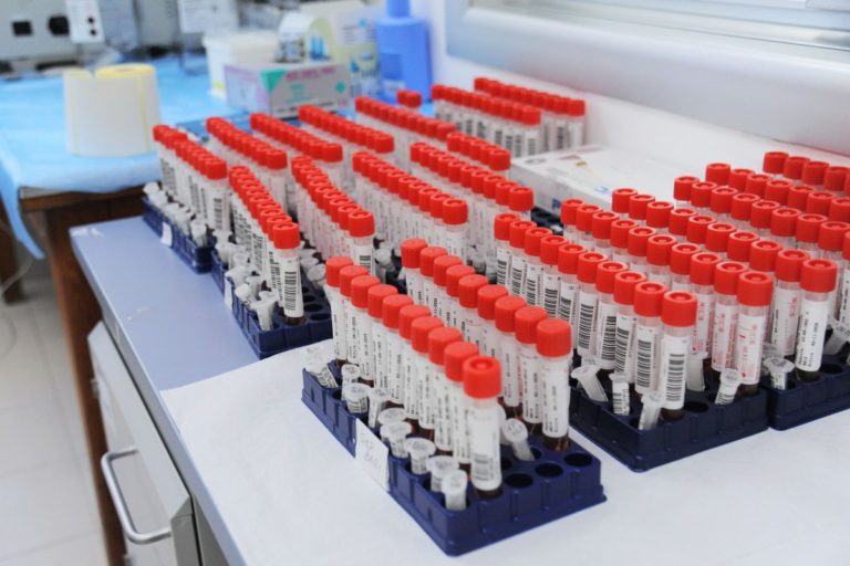 Fnopi “Sui tamponi garantire massima sicurezza a pazienti”