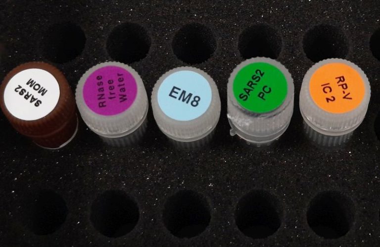 La Fondazione Kennedy dona migliaia di kit per tamponi al Bambino Gesù