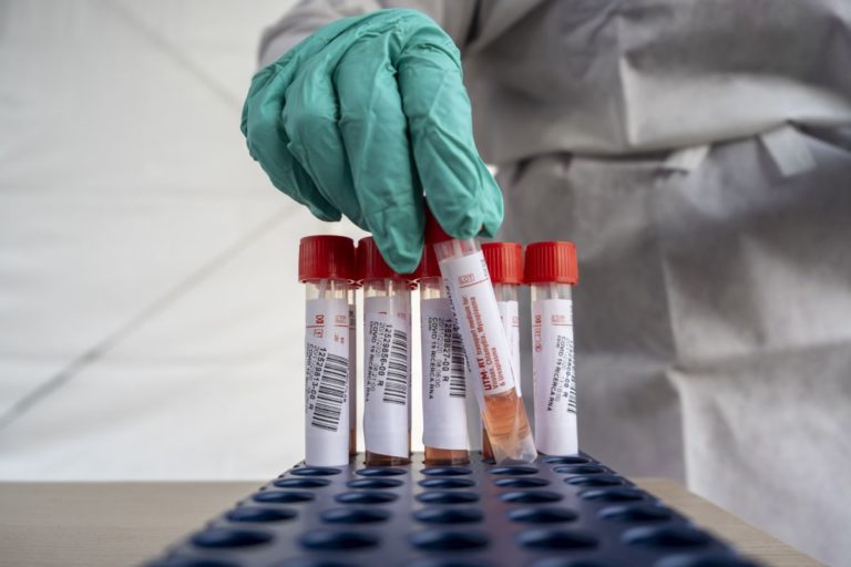 Coronavirus, 2 decessi e 27 nuovi positivi in Valle d’Aosta