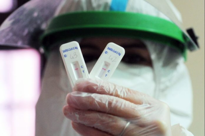 COMUNE DI BARI TEST SIEROLOGICI PER I DIPENDENTI