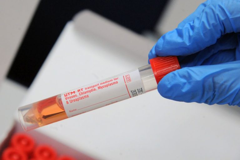 Coronavirus, 100 nuovi casi e 8 decessi in Sardegna