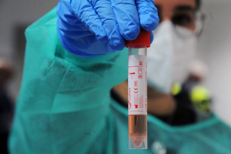 Coronavirus, nessun decesso e 8 nuovi positivi in Valle d’Aosta