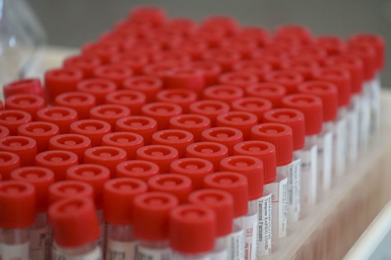 Coronavirus, 61 decessi e 1.861 nuovi positivi in Piemonte