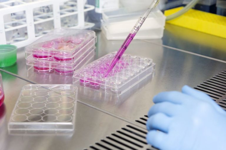 Parkinson, dallo studio di una forma ereditaria una possibile terapia