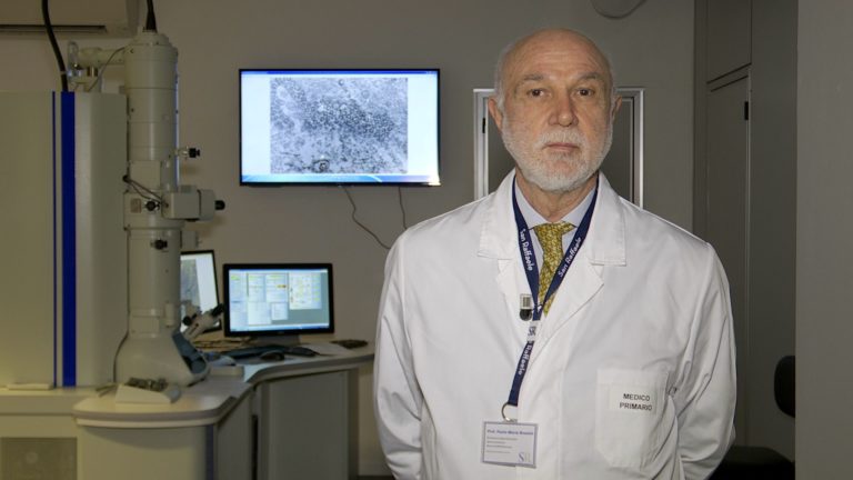 Alzheimer, alterazioni attività del cervello durante sonno e veglia