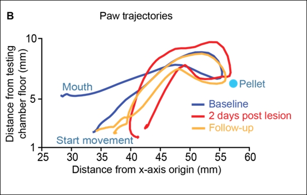 Riabilitazione post-ictus, nuovo approccio tra robotica e serotonina