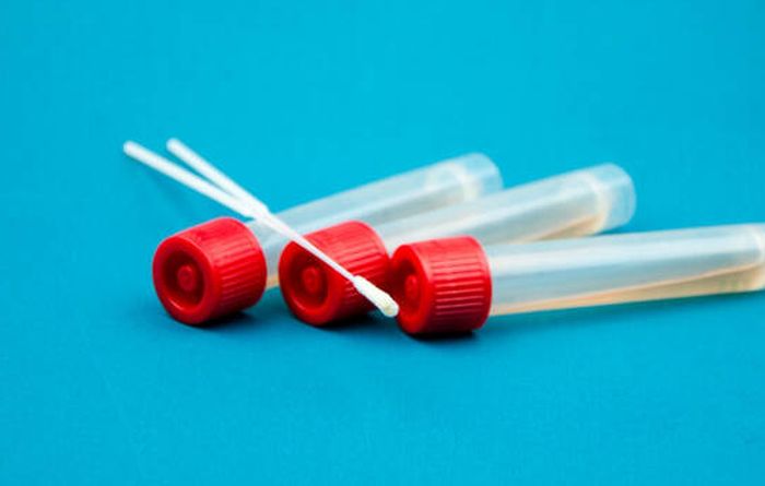 Covid, in Piemonte 191 nuovi casi e 2 decessi