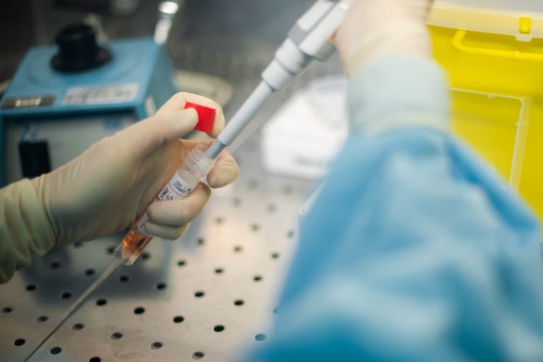 Covid, le allergie non un fattore di rischio per le forme più severe