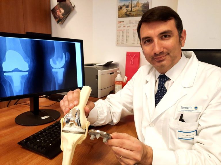 Al Gemelli protesi del ginocchio da stampante 3d, prima al mondo