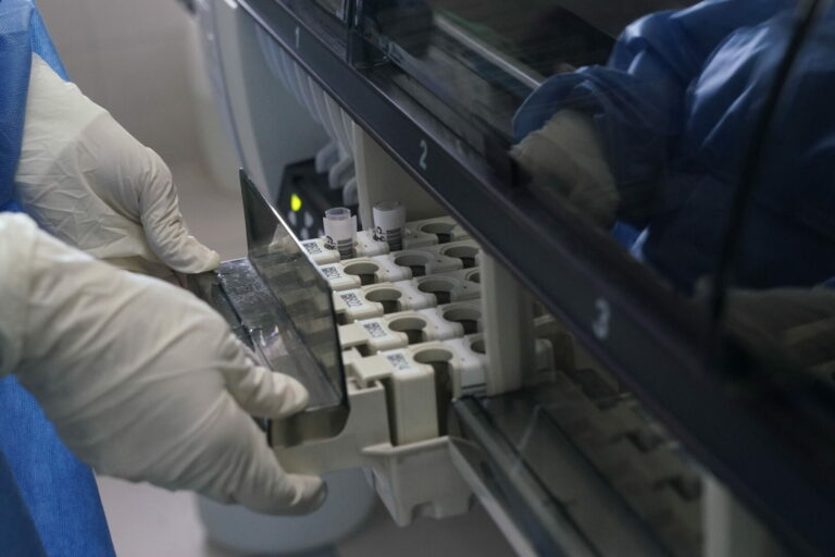 Covid, studio su anticorpi monoclonali tetravalenti contro il virus