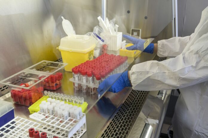 CAMPUS BIO MEDICO LABORATORIO TAMPONI COVID-19