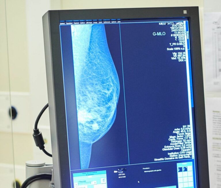 La senologia italiana ha retto all’urto del Covid-19