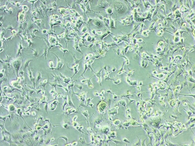 Covid, isolata in Puglia la variante Omicron