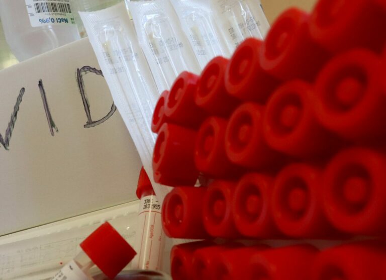 Covid, in Abruzzo 921 nuovi casi e 3 decessi in 24 ore