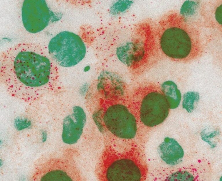 Covid, scoperto un nuovo meccanismo di resistenza immunitaria