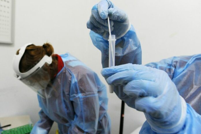 TAMPONI RAPIDI A PREZZI CALMIERATI ATTIVATI DALLA CROCE ROSSA, TAMPONE RAPIDO