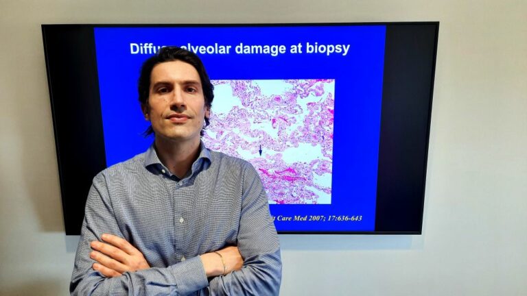 Vaccino Covid, studio Gemelli su rischio riacutizzazione in pazienti IPF