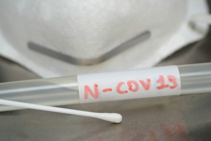 Europa, Italia Milano - Tampone e esame del sangue per rilevare la positivita' al n-cov19 Coronavirus - analisi in ospedale - sanita' pubblica