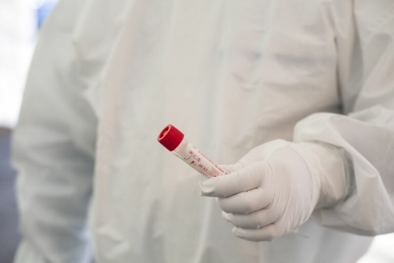 Report Altems, dimezzato il numero di nuovi casi Covid nell’ultimo mese