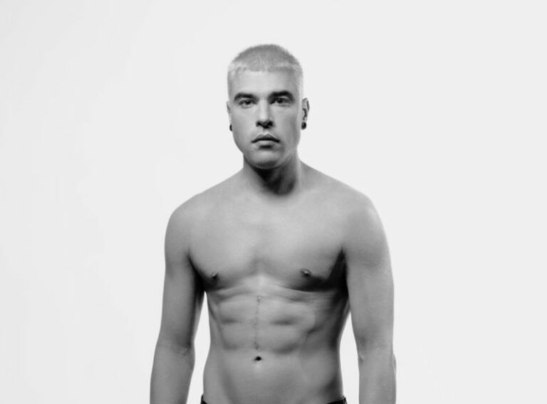 Fedez torna con il nuovo singolo “Crisi di Stato”