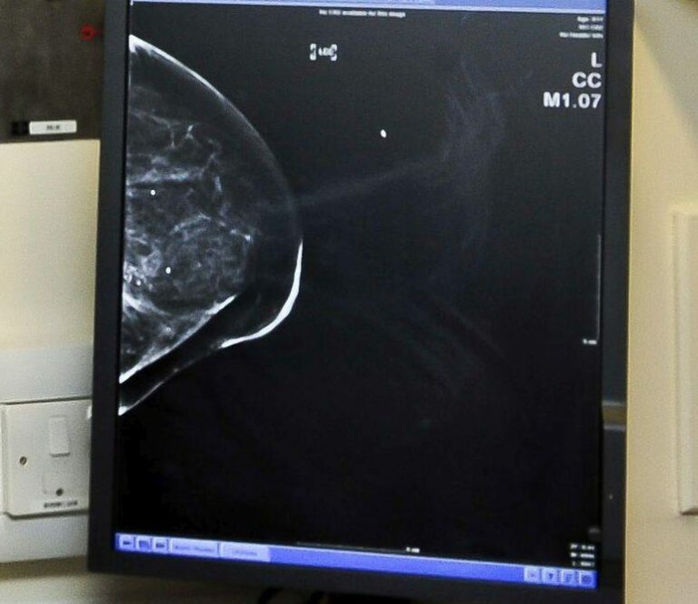 Tumore al seno, Fda approva un nuovo farmaco di Menarini