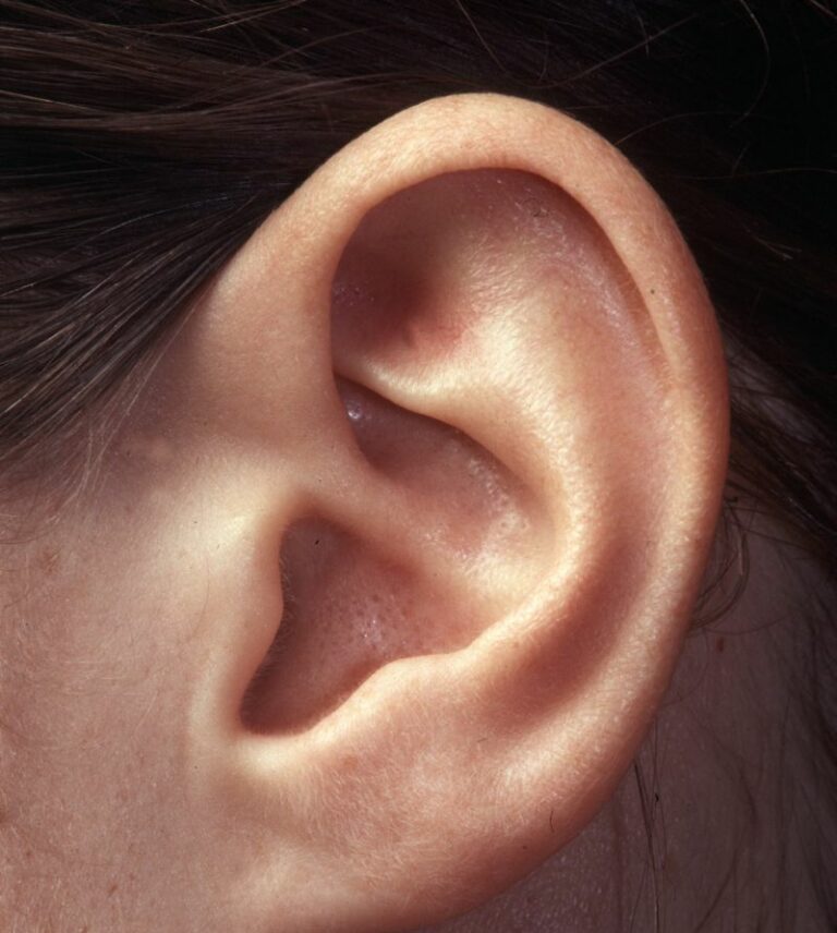 World Hearing Day, nel mondo 1 persona su 5 soffre di un calo dell’udito