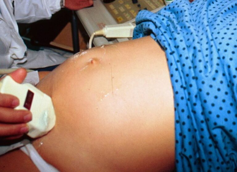 Malta, majority against abortion, PM decisive to introduce amendments