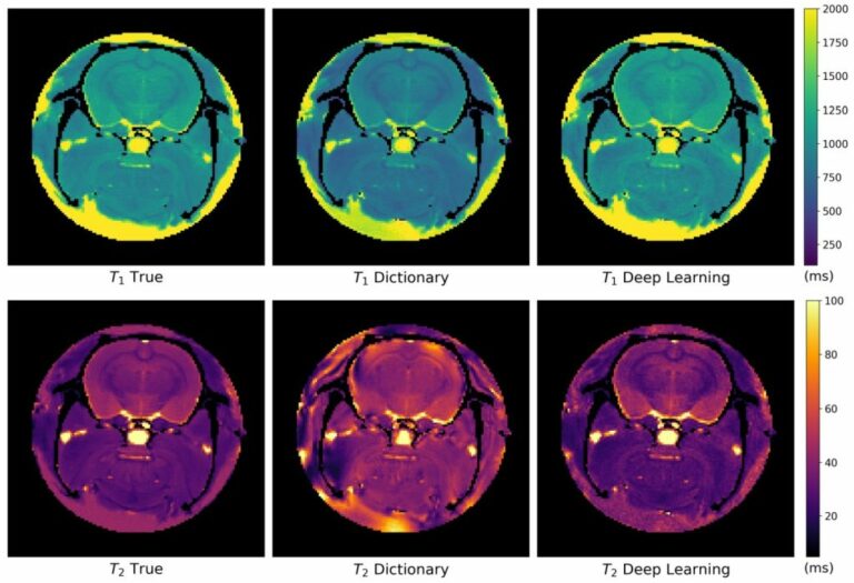 Con intelligenza artificiale lettura risonanza magnetica in 10 secondi