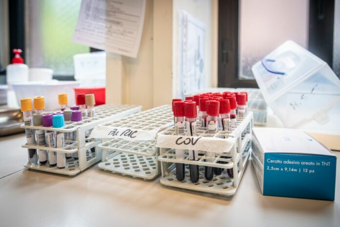 Test sierologici COVID-19 ai privati. Ospedale San Giuseppe Multimedica in via San Vittore