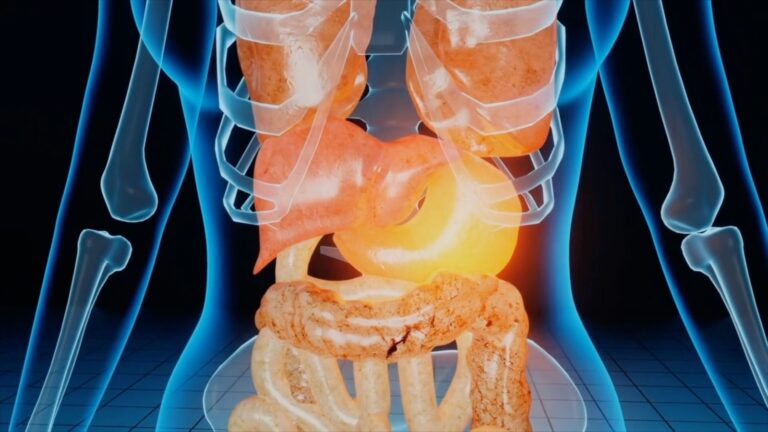 Calcoli alla colecisti, ittero e pancreatite i pericoli maggiori