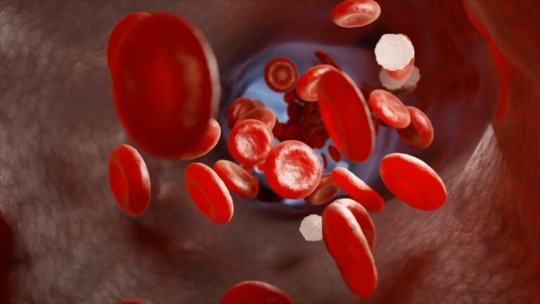 Trombosi alla base di gravi malattie, in Italia 600.000 ogni anno