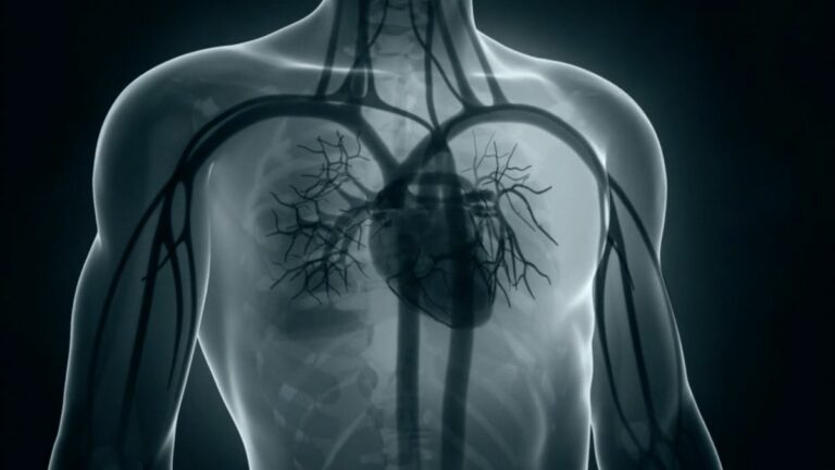 Tumore ai polmoni, ripresa più rapida grazie alla chirurgia robotica