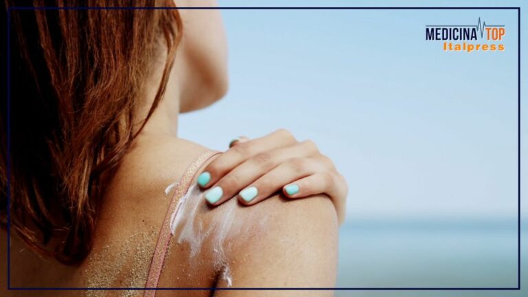 Ustioni e tumori, i rischi di un’eccessiva esposizione al sole
