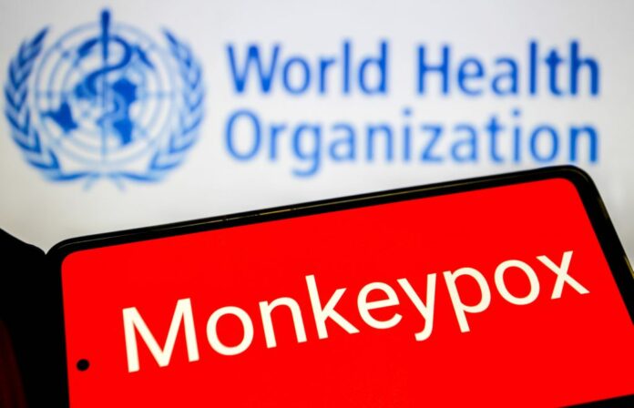 Foto di Archivio - Mpox - Vaiolo delle scimmie, l'Oms lancia l'emergenza sanitaria mondiale - Foto di repertorio